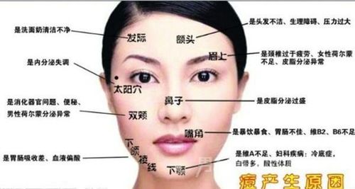 脸上长痘痘的位置图