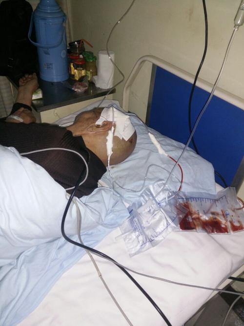 父亲脑出血住院记