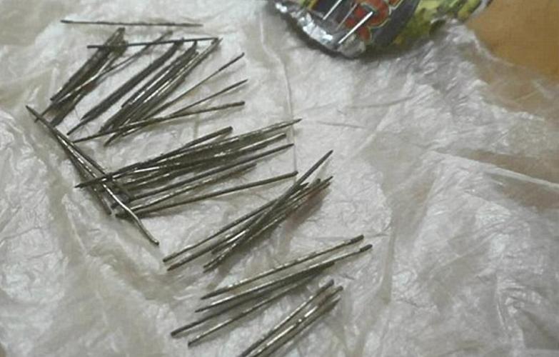 印度女子双腿长出70多根钢针,她声称自己毫不知情