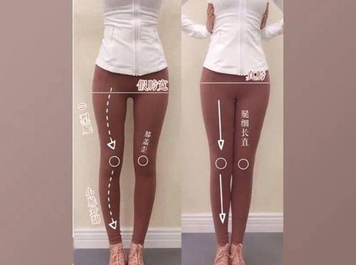 【医文医话】俞沙:假胯宽,怎么办?