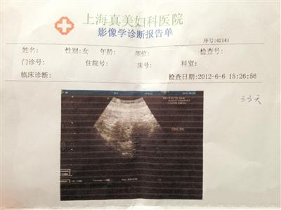 袁莉怀孕1月坚持拍戏 洋老公心疼盼早日放假(图)