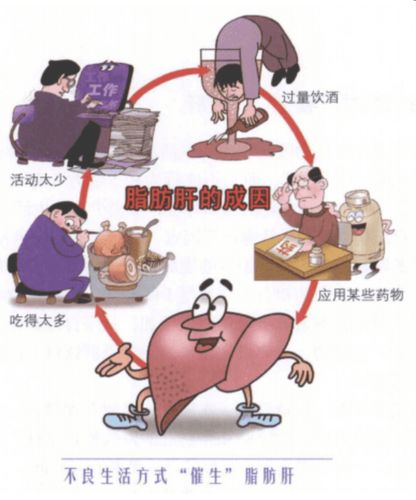 健康科普-正确的认识脂肪肝以及怎样才能去除脂肪肝?