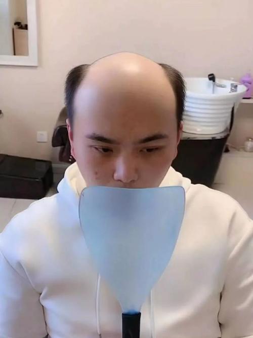 90%脱发的人会变秃,拿什么拯救你的头发?神木这家店有