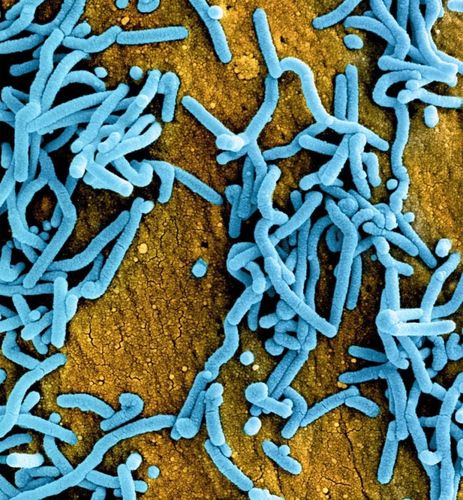 埃博拉病毒(ebola virus)