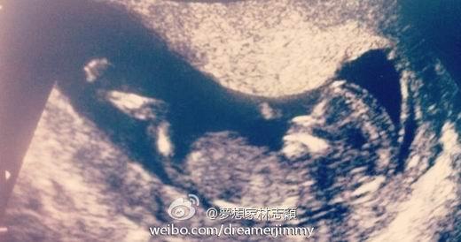 林志颖否认妻子怀第二胎 婴儿b超照片系妹妹小孩