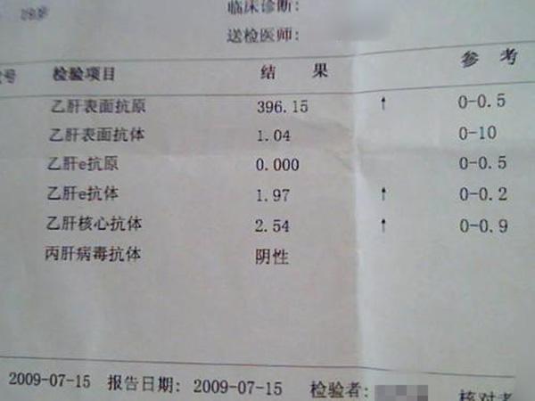 乙肝五项对照表