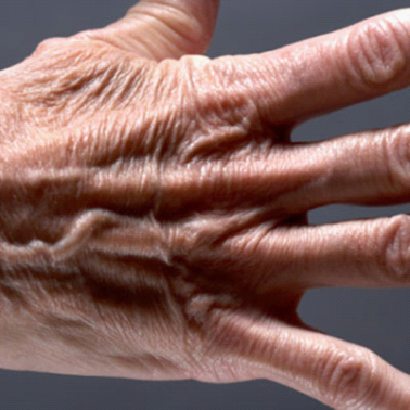 恶习2:忽略手和脖子的保养