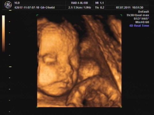 宝宝的第一张照片-孕24周