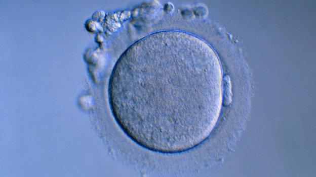 显微镜下的人类卵子.图片来源:pascal goetgheluck/science source