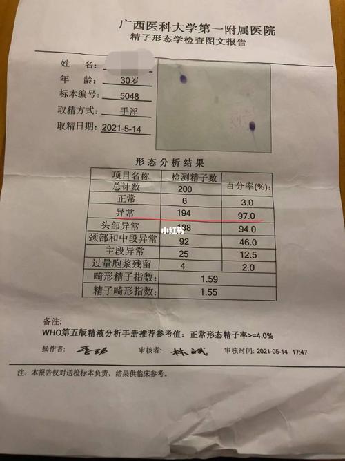 精子质量差_怀孕_胎停_医疗健康_医疗健康其他