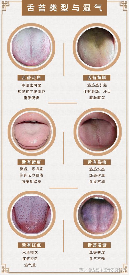 气虚型,通常指肺脾肾气虚,主要表现有舌质淡,舌苔薄白,舌体胖嫩,舌边