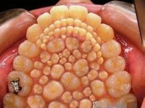 那么,这么多牙齿长在哪里呢?原来是密集分布在嘴巴上颚.