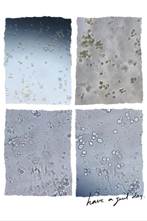 学生作品:显微镜下的酵母菌.