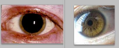 人死后瞳孔为什么会散大