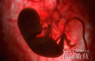 胎儿在子宫里的真实照片(组图)(2)