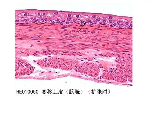 变移上皮(膀胱)(扩张时)