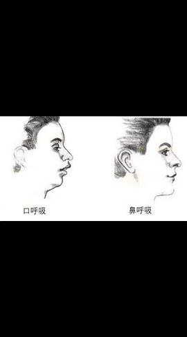 口呼吸会让人发腮么