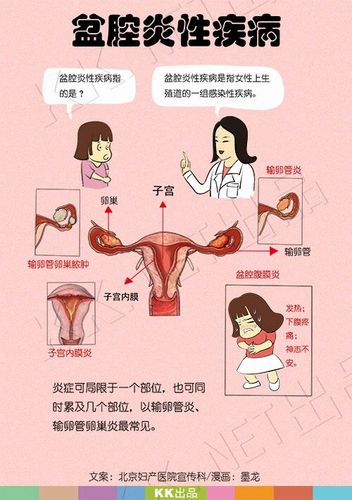 盆腔积液 子宫癌