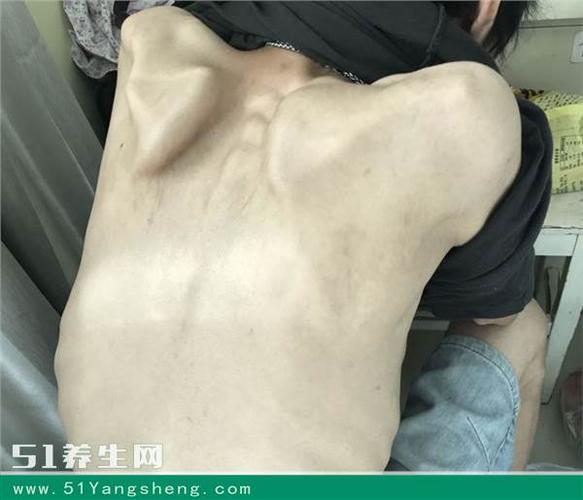 男孩暴饮暴食却骨瘦如柴,到医院一检查,跪求医治!