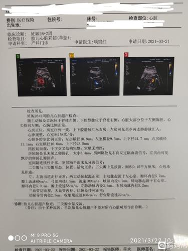四维检查出胎儿三尖瓣轻度反流,隔一个月去