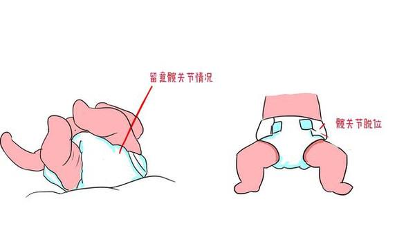 一位妈妈这样做竟差点使宝宝致残,看完都惊呆了!