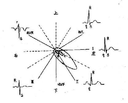 诊断学/心电向量与心电图的关系