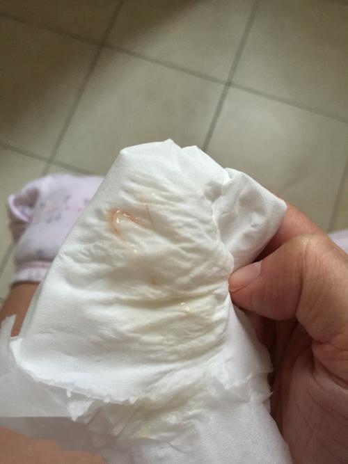 有图慎入今天预产期早上起来发现有一点点血丝不知道是不是见红有懂的