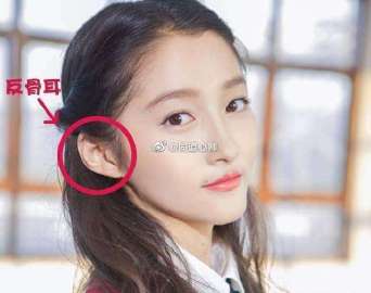 面相解析:反骨耳 耳朵的外边是耳轮,耳朵内圈突起的部分是耳廓,如果