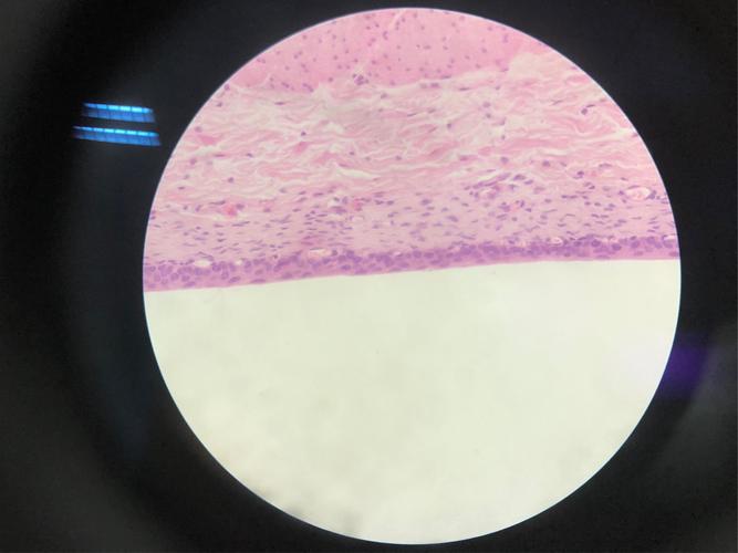 40×充盈状态的变移上皮