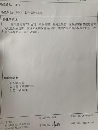 今天又知道了还有鼻窦ct