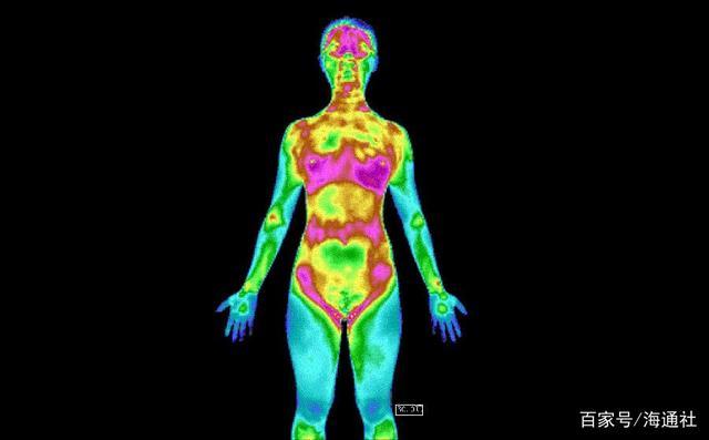 红外热像技术检测的人体红外热像图