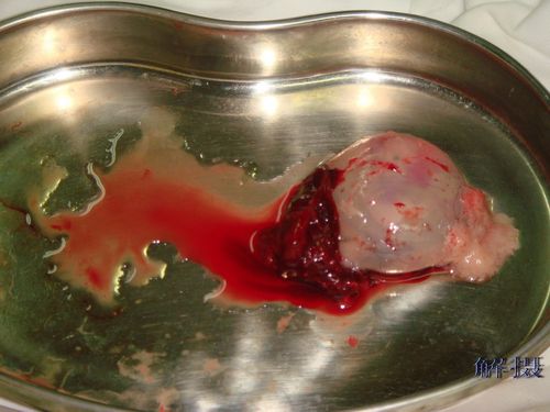 生命之源——人类最震撼的一组摄影