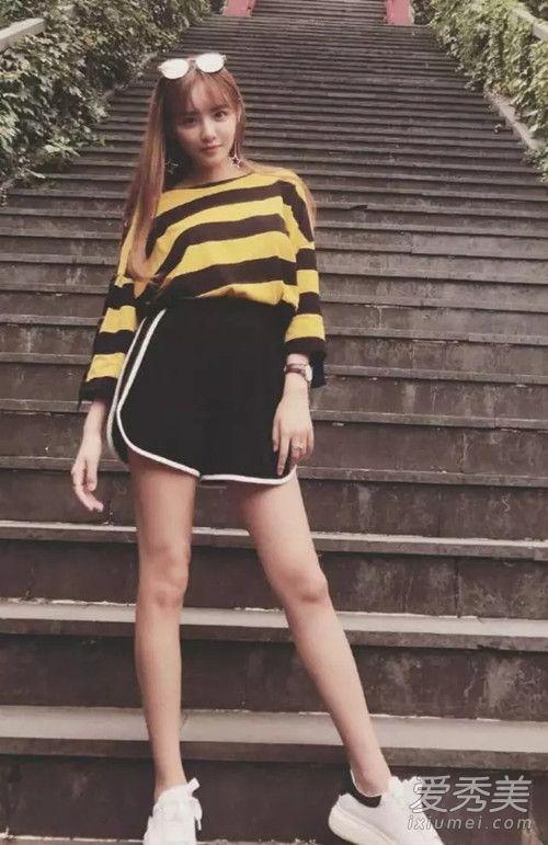 抖音兔子牙整容了吗 抖音兔子牙整容前后照片对比 抖音兔子牙整容了吗