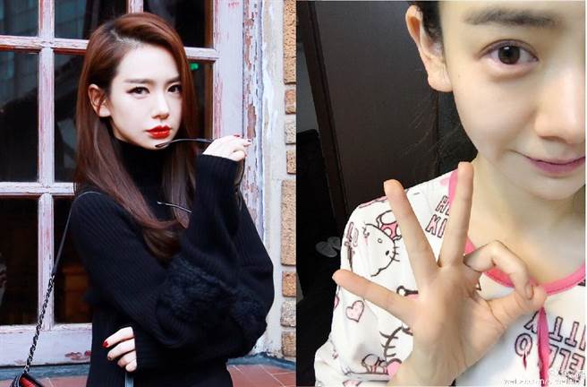 戚薇在日本拍戏受伤,透过微博报平安.