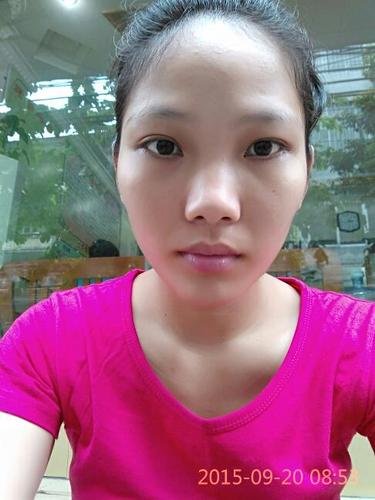 我的脸腮骨太高了,大家给点意见?