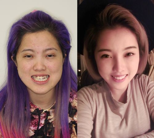 地包天,朝天鼻非主流女孩蜕变活力美少女