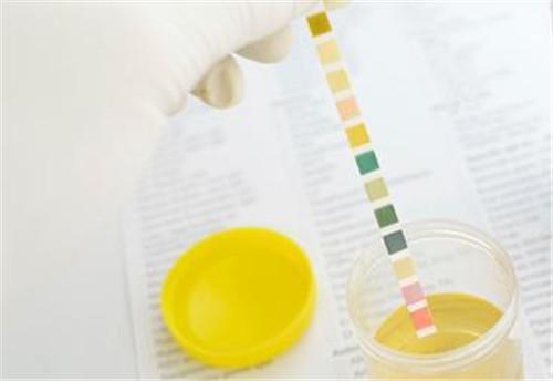 如果眼睛能看出尿呈"洗肉水样"或带血色,甚至尿中有血丝或血凝块,叫做