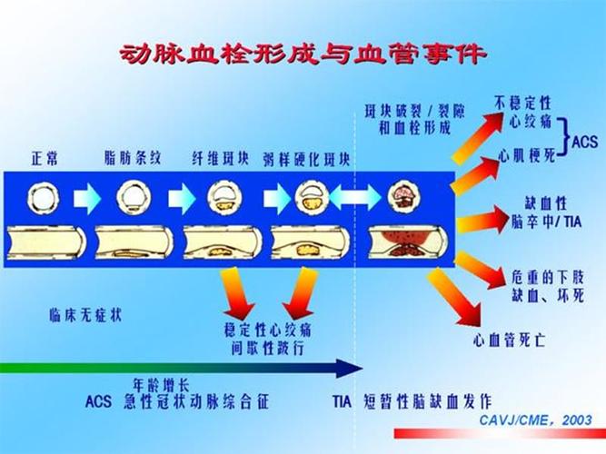 急性冠脉综合征他汀序贯治疗ppt课件