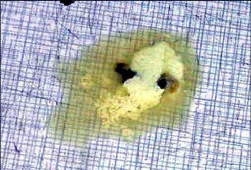 病鸡下痢,粪便呈白色黏液状