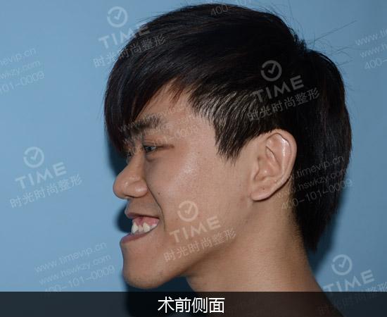 男人地包天是穷人面相?