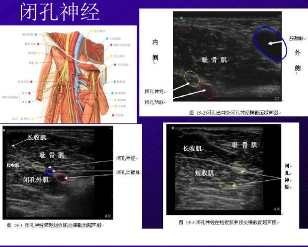 之路(四)超声引导下股神经 坐骨神经 闭孔神经 股外侧皮神经阻滞