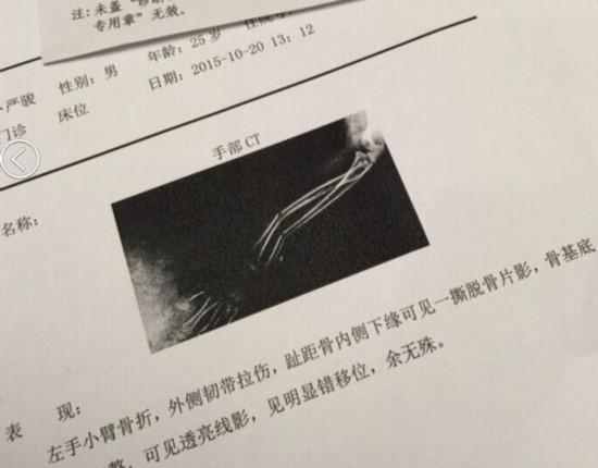 主播们的"副业"--陈一发,pdd还能播什么?