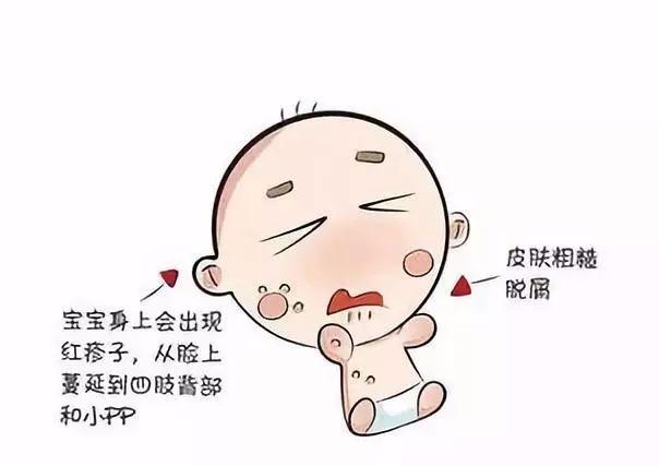 小孩湿疹小儿湿疹图片