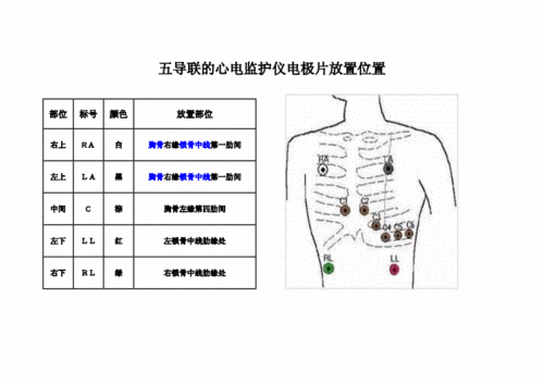 五导联的心电监护仪电极片放置位置同名486doc6页