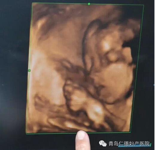 【婷婷孕周记】孕24周:四维彩超,宝宝吐舌头
