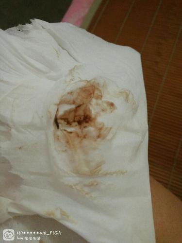 亲们刚开始流的是血第二天跟月经最后一天似的今天流的是这我吓人