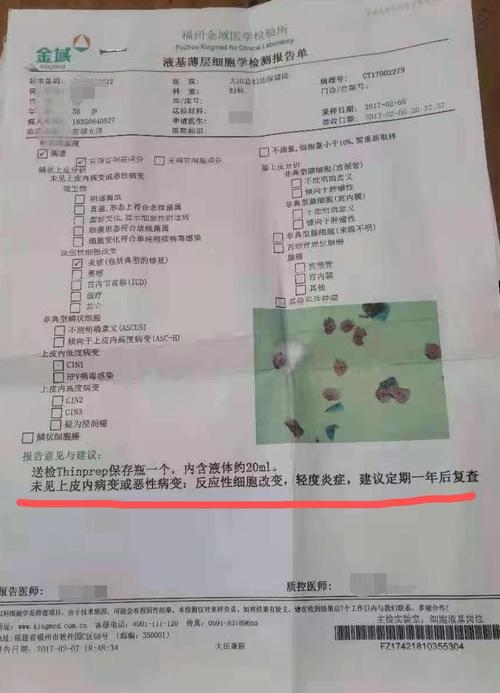 那么既然只是普通的妇科炎症,为何会成为田女士身患鼻咽癌却无法申请