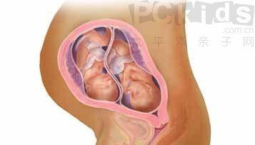 看的见的双胞胎发育全过程