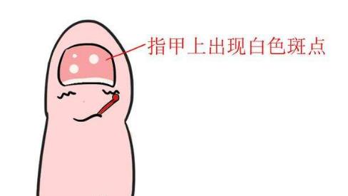 孩子有这5个症状,说明肚里长蛔虫了!