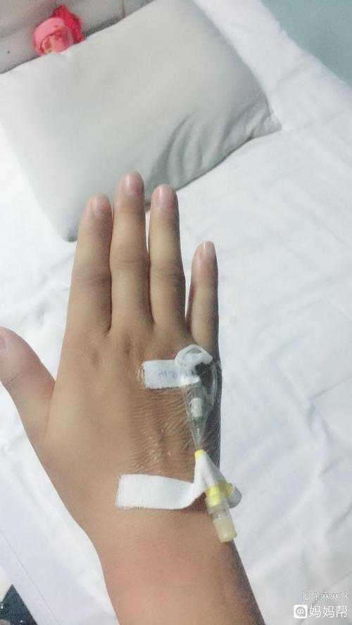 输液手都输成猪蹄了